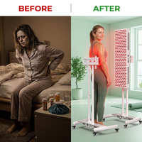 Red Light Therapy Device with Stand - Moving Pro Series Professional Edition — Before & After